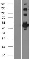 MAPKAP Kinase 2 (MAPKAPK2) Human Over-expression Lysate