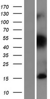 TIAF1 Human Over-expression Lysate