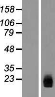 ZNHIT3 Human Over-expression Lysate