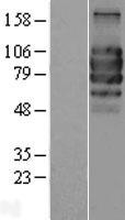 TCCR (IL27RA) Human Over-expression Lysate