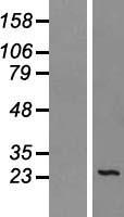 SEC22L1 (SEC22B) Human Over-expression Lysate