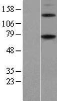 ENTPD4 Human Over-expression Lysate