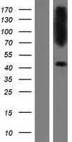 CTNS Human Over-expression Lysate