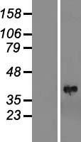 LIMS1 Human Over-expression Lysate