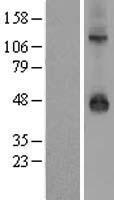 KCNJ9 Human Over-expression Lysate