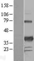 PITX3 Human Over-expression Lysate