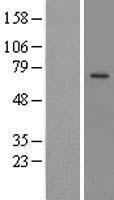 PRCP Human Over-expression Lysate