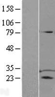 TPD52 Human Over-expression Lysate
