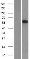 EAAT4 (SLC1A6) Human Over-expression Lysate