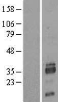 SIAH2 Human Over-expression Lysate