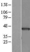 ACTC1 Human Over-expression Lysate