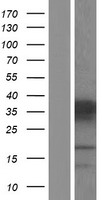 PHOX2A Human Over-expression Lysate