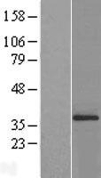 ATP5F1C Human Over-expression Lysate