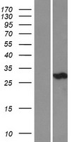 Carbonic Anhydrase III (CA3) Human Over-expression Lysate