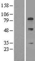 COL13A1 Human Over-expression Lysate