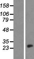 beta Crystallin A3 (CRYBA1) Human Over-expression Lysate