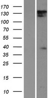 DIAPH1 Human Over-expression Lysate