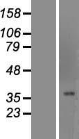 FOXG1 Human Over-expression Lysate