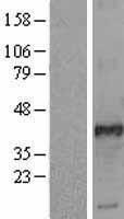 FRA2 (FOSL2) Human Over-expression Lysate