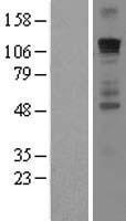 GLI1 Human Over-expression Lysate