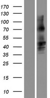 GJA8 Human Over-expression Lysate