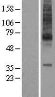 MCHR (MCHR1) Human Over-expression Lysate