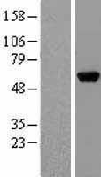 Alanine Transaminase (GPT) Human Over-expression Lysate