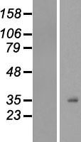 H10 (H1F0) Human Over-expression Lysate