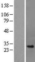 Histone H1.4 (HIST1H1E) Human Over-expression Lysate