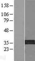KIF25 Human Over-expression Lysate