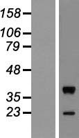 MOS Human Over-expression Lysate