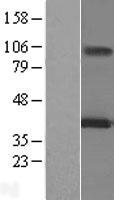 MAGEA12 Human Over-expression Lysate