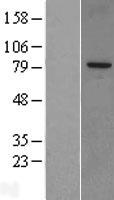 SnoN (SKIL) Human Over-expression Lysate