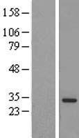 MED6 Human Over-expression Lysate