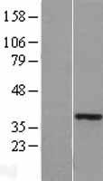 HOXA11 Human Over-expression Lysate