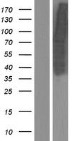 IRS1 Human Over-expression Lysate