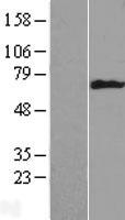 Cytokeratin 6B (KRT6B) Human Over-expression Lysate