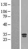 NGAL (LCN2) Human Over-expression Lysate