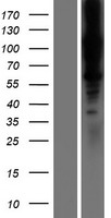 LOXL1 Human Over-expression Lysate