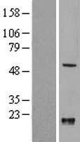 KLF10 Human Over-expression Lysate