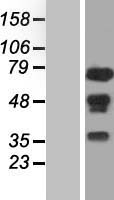 WHSC2 (NELFA) Human Over-expression Lysate