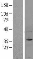 UFD1 Human Over-expression Lysate