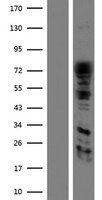 DRP1 (DNM1L) Human Over-expression Lysate