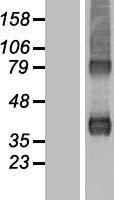 ARPC1B Human Over-expression Lysate
