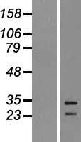 EBI3 Human Over-expression Lysate