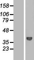 WDR68 (DCAF7) Human Over-expression Lysate