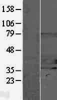 STUB1 Human Over-expression Lysate