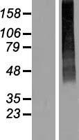 SLC17A2 Human Over-expression Lysate