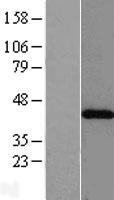 ACAT2 Human Over-expression Lysate