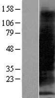 MT1B Human Over-expression Lysate